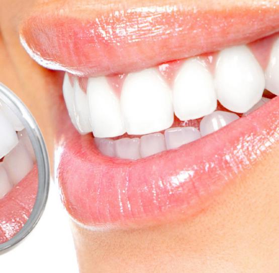 Ինչպե՞ս է պետք ճիշտ խնամել ատամները, որպեսզի խուսափեք հետագա բարդացումներից․ Ատամնաբույժի խորհուրդները