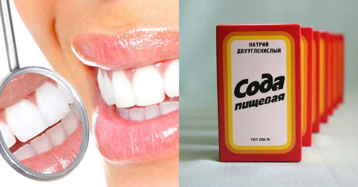Ջերմակ սպիտակ ատամներ ունենալու համար պետք չէ դիմել բժշկական միջամտության, այս միջոցը կօգնի ձեզ
