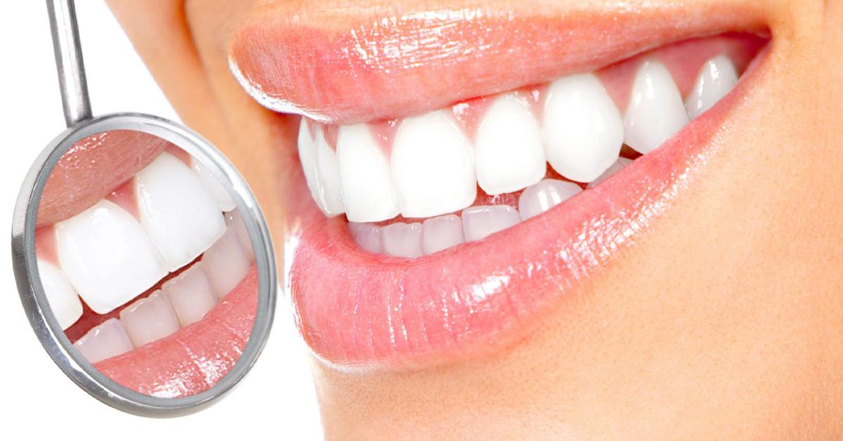 Ինչպե՞ս է պետք ճիշտ խնամել ատամները, որպեսզի խուսափեք հետագա բարդացումներից․ Ատամնաբույժի խորհուրդները